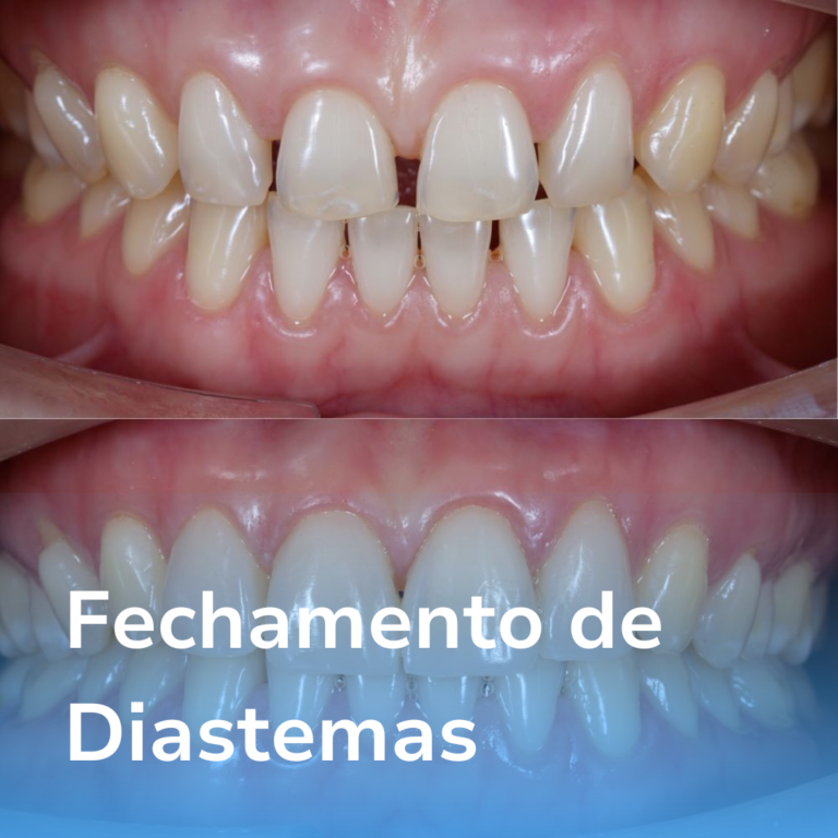 Procedimentos Dra. Natália